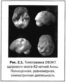 Дэниэл Амен - Великолепный мозг в любом возрасте