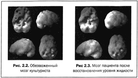 Дэниэл Амен - Великолепный мозг в любом возрасте