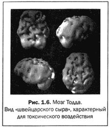 Дэниэл Амен - Великолепный мозг в любом возрасте