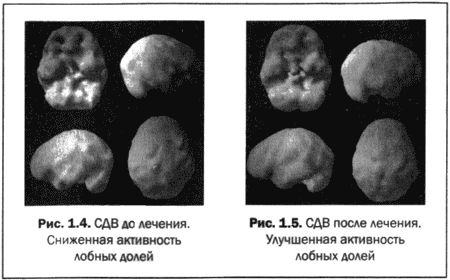 Дэниэл Амен - Великолепный мозг в любом возрасте