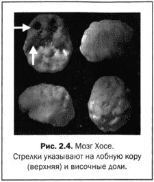 Дэниэл Амен - Великолепный мозг в любом возрасте