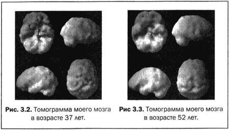 Дэниэл Амен - Великолепный мозг в любом возрасте