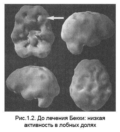 Дэниел Амен - Измени свой мозг - изменится и тело!