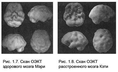 Дэниел Амен - Измени свой мозг - изменится и тело!