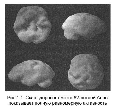 Дэниел Амен - Измени свой мозг - изменится и тело!