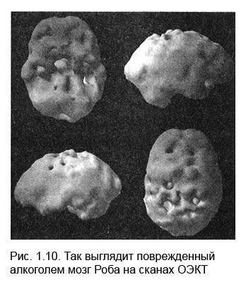 Дэниел Амен - Измени свой мозг - изменится и тело!