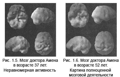 Дэниел Амен - Измени свой мозг - изменится и тело!