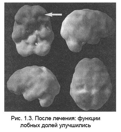 Дэниел Амен - Измени свой мозг - изменится и тело!