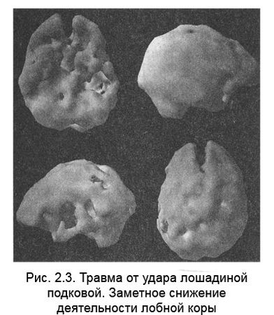 Дэниел Амен - Измени свой мозг - изменится и тело!