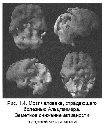 Дэниел Амен - Измени свой мозг - изменится и тело!