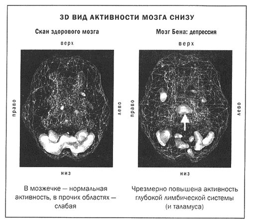 Дэниел Амен - Мозг и душа