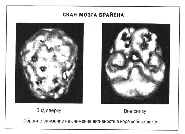 Дэниел Амен - Мозг и душа