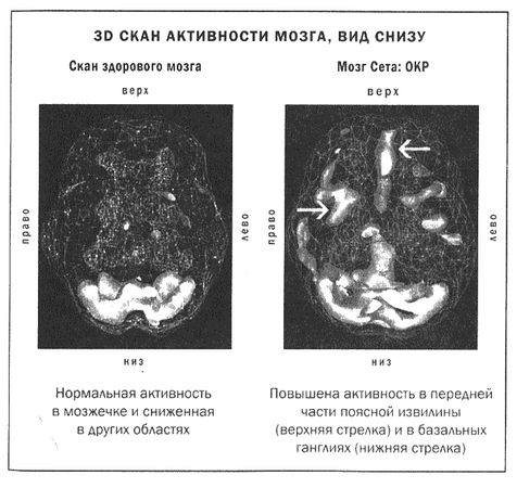 Дэниел Амен - Мозг и душа