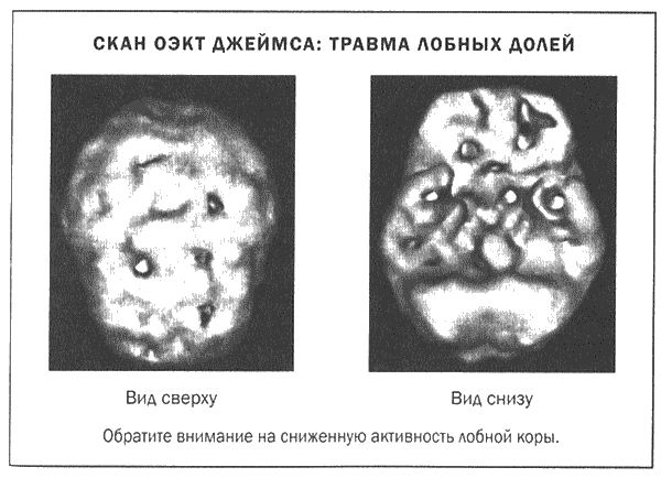 Дэниел Амен - Мозг и душа