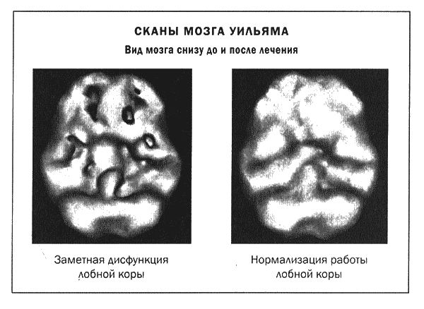 Дэниел Амен - Мозг и душа