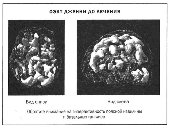 Дэниел Амен - Мозг и душа