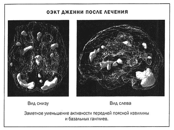 Дэниел Амен - Мозг и душа